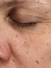 Close up of face after using product